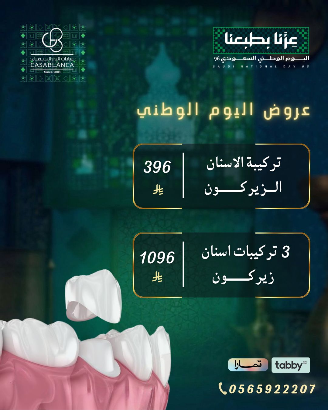 تركيبة الزيركون 396 ريال